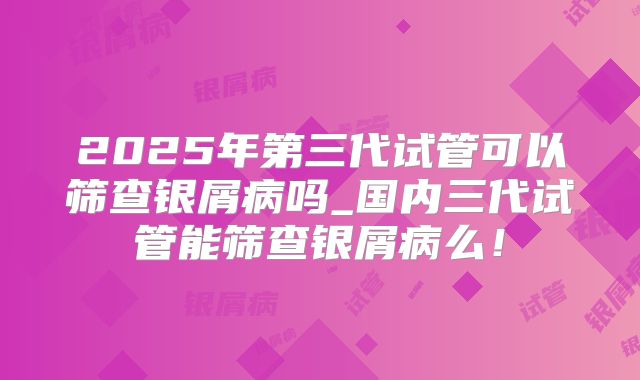 2025年第三代试管可以筛查银屑病吗_国内三代试管能筛查银屑病么!