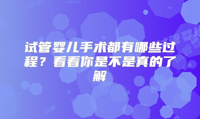 试管婴儿手术都有哪些过程?看看你是不是真的了解