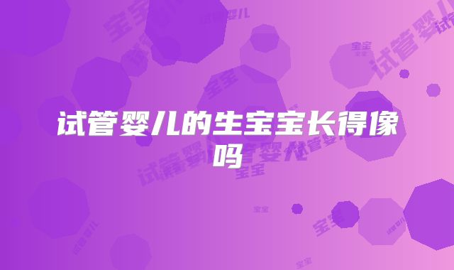 试管婴儿的生宝宝长得像吗