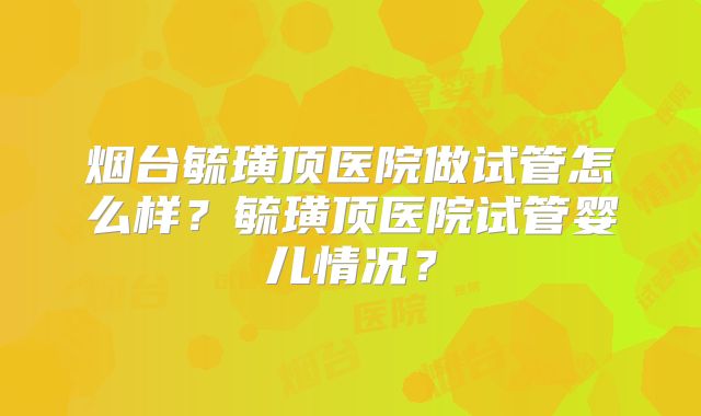 烟台毓璜顶医院做试管怎么样?毓璜顶医院试管婴儿情况?