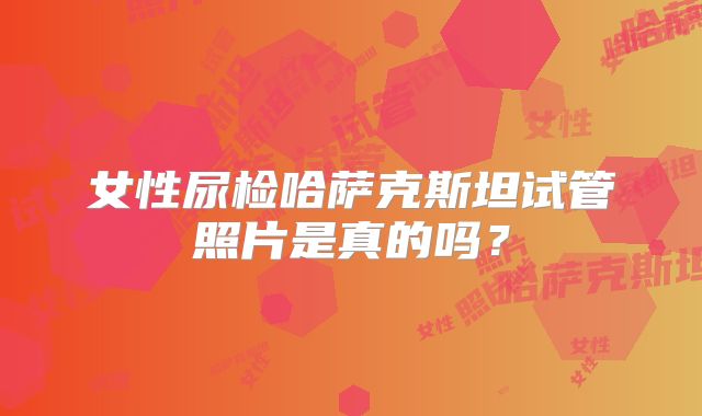 女性尿检哈萨克斯坦试管照片是真的吗?