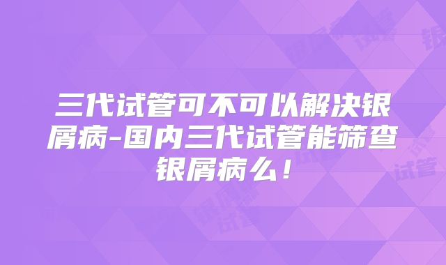 三代试管可不可以解决银屑病-国内三代试管能筛查银屑病么！